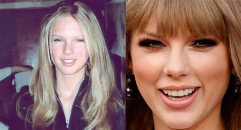 Taylor Swift Teeth Amazing Transformations Over The Years Oral Care
