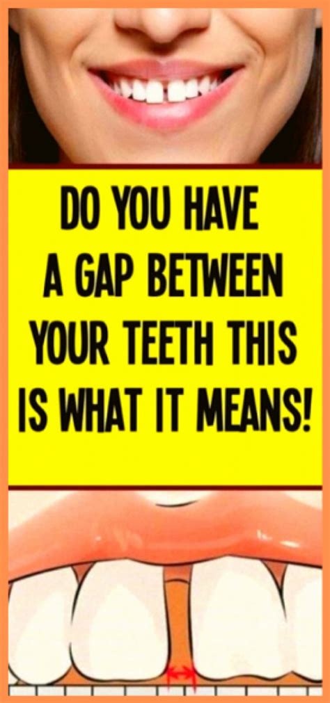 do you have a gap between your teeth this is what it means in 2021 teeth gap health