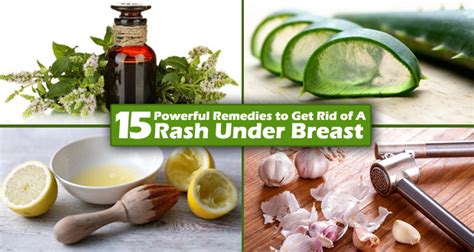 15 Remedies To Get Rid Of Rashes Under Breast 2022