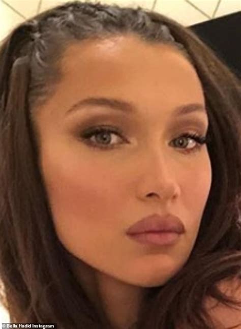 Bella Hadid Flaunts Incredibly Plump Pout After Denying Any Lip