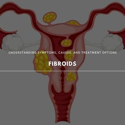 Breaking Down Fibroids Symptoms Causes And Treatment Options