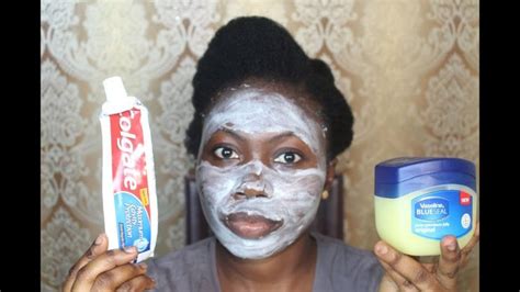 To avoid snapping the needle, do your best to remove it in a single, straight motion. I APPLIED COLGATE TOOTHPASTE & VASELINE ON MY FACE, THIS ...