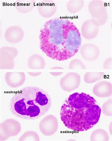 Fileneutrophil And Eosinophil 01 Embryology