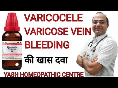 Varicocele Hamamelis Vir Varicose Vein Bleeding Piles YouTube