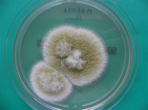 Aspergillus flavus is a saprotrophic and pathogenic fungus with a cosmopolitan distribution. ATLAS MICOLOGIA: ASPERGILLUS FLAVUS