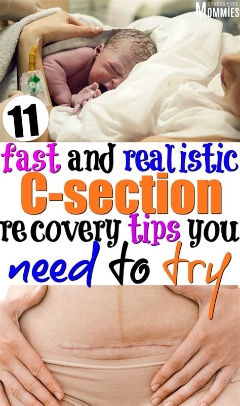11 Fast And Realistic C Section Recovery Tips What To Do After A C Section