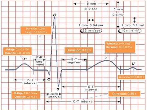 Un Electrocardiograma Conocido Por Sus Siglas Como Ec Vrogue Co
