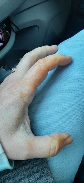 Rust Colored Stains On Hands Overnight Asking List