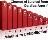 Patients present as pulseless, unresponsive, and apneic. What is Sudden Cardiac Arrest? - Arizona Heart Rhythm Center