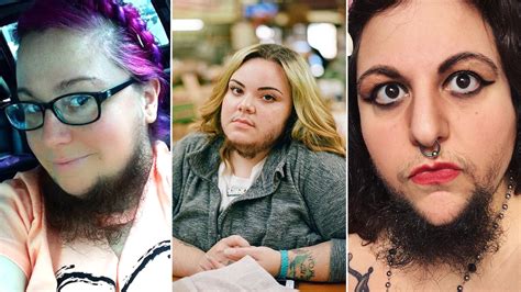 Women With Pcos Explain Why They Celebrate Their Facial Hair Allure
