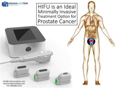 Hifu Is An Ideal Minimally Invasive Treatment For Prostate Cancer Indianmedtrips Blog
