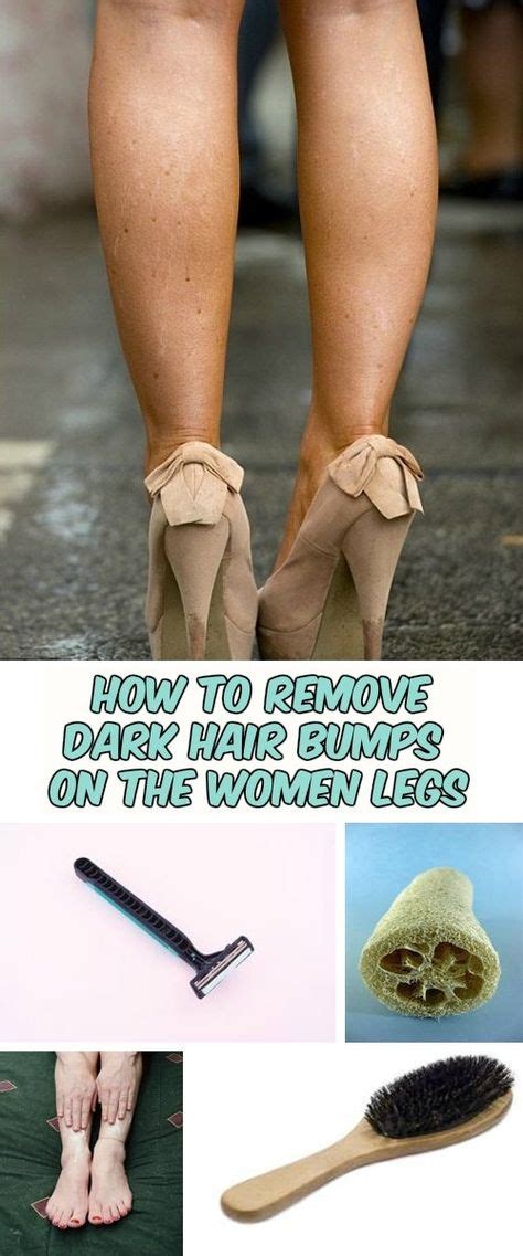 How To Remove Dark Hair Bumps On The Women Legs Bump Hairstyles Ingrown Hair Ingrown Hair