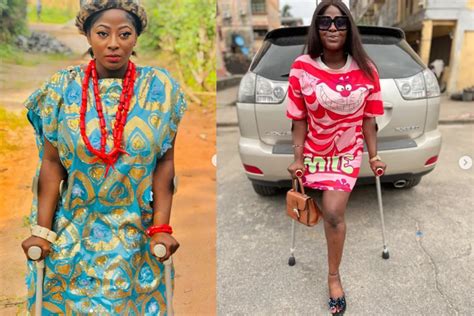 She Lost Her Leg At 13 See Beautiful Photos Of The Nollywood Actress