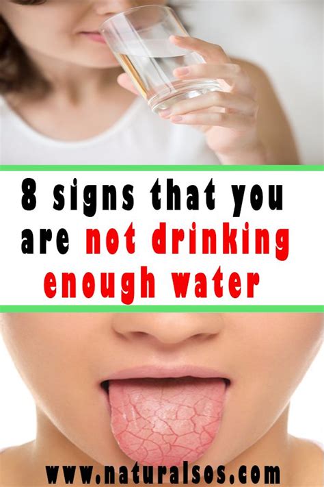 8 Signs That You Are Not Drinking Enough Water Not