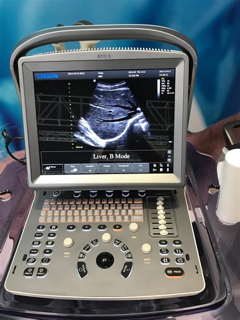 Fda And Ce Color Doppler Echography Machine Chison Eco5 Portable Color