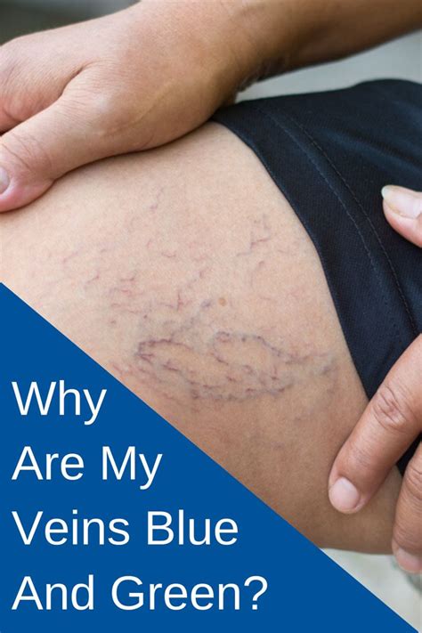 Why Are My Veins Blue And Green Usa Vein Clinics Green Veins Vein