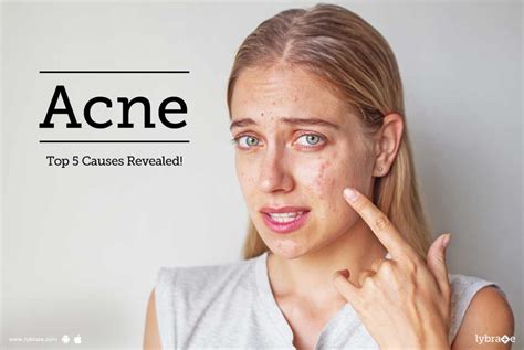 Acne Top 5 Causes Revealed By Dr Suruchi Puri Lybrate