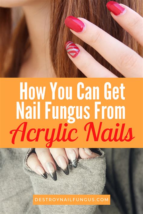 Nail Fungus And Acrylic Nails What Do You Need To Know