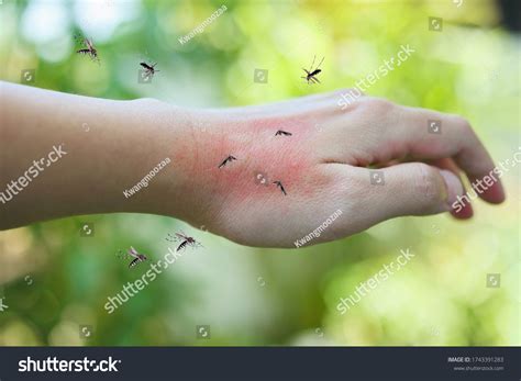 Mosquito Over 75047 Royalty Free Licensable Stock Photos Shutterstock