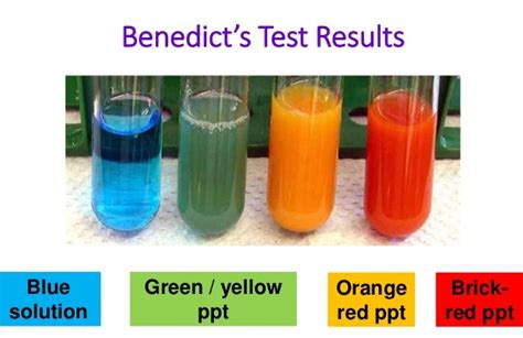 Benedicts Test Objective Principle Reagents Procedure And Result