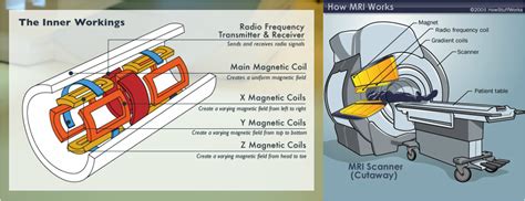 The chestpiece, also known as the head, is the part of the stethoscope responsible for conducting sound. How Does MRI Work? - MRI