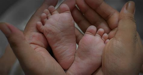 Rare Conjoined Twins Born With Two Heads Three Hands In Odisha
