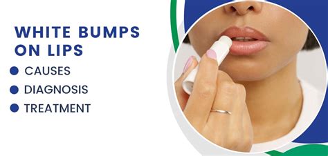 White Bumps On Lips Causes Diagnosis And Treatment