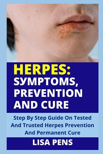 herpes ЅУmРtОmЅ РrЕvЕntІОn Аnd cure step by step guide on tested and trusted herpes