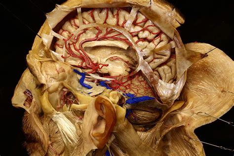 Elaborate Dissection of Cadaveric Head | Neuroanatomy | The