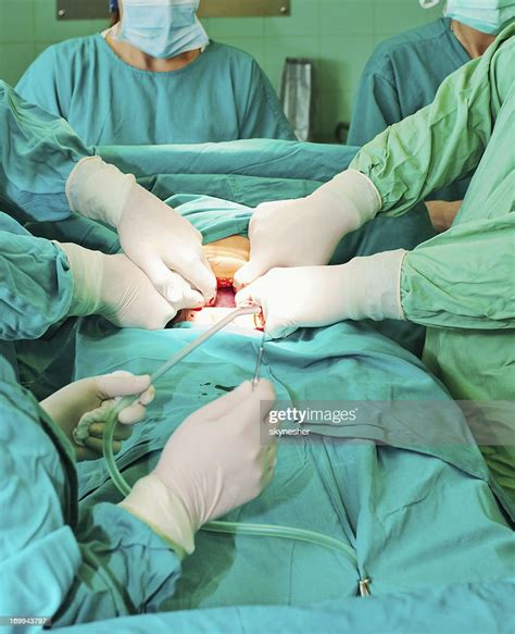 Doctors Performing Real Caesarean Birth High Res Stock Photo Getty Images