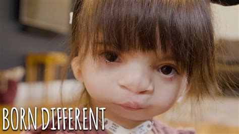 nova our girl with a mystery condition born different youtube