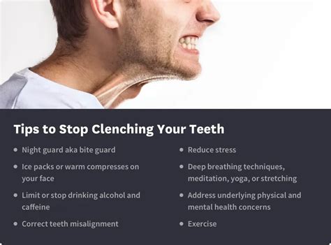 How To Stop Clenching Your Teeth Tips And Effects Byte®