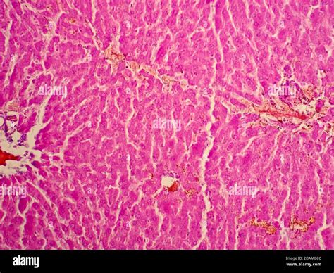 Human Liver Tissue Light Micrograph Stock Photo Alamy