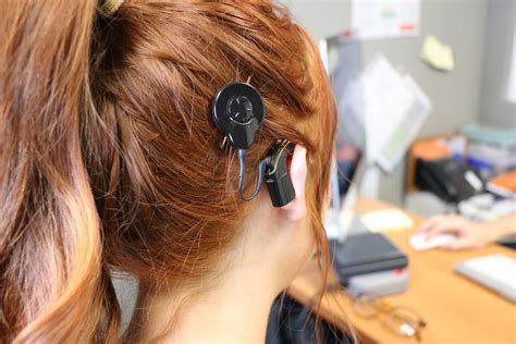 The Advantages And Disadvantages Of Cochlear Implants 2023 Guide Matte World 2023