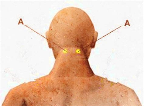 Stimulating Those Points To Help Headach And Neck Pain Location Below