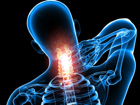 Holistic Treatment Options For Neck Pain Chiropractors In Oviedo