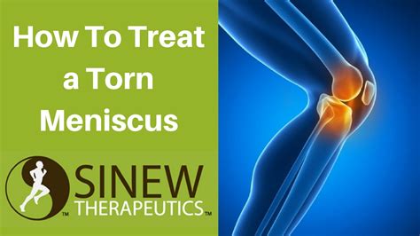 How To Treat a Torn Meniscus and Speed Recovery 