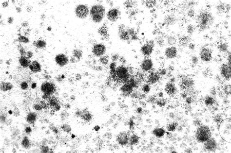 Stachybotrys chartarum or black mold is a type of microfungus that releases spores and mycotoxins that have been found to be toxic in humans and pets. Don't let black mold get you down | Florida Keys Weekly ...