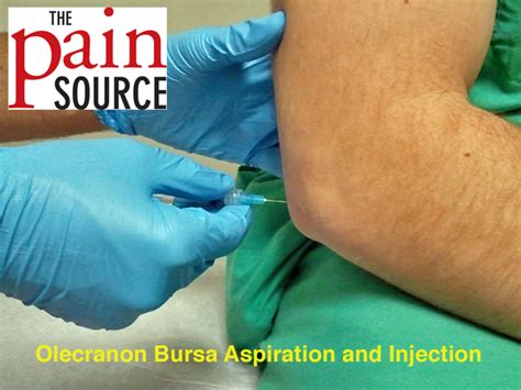 Cpt Code For Incision And Drainage Of Olecranon Bursa Best Drain