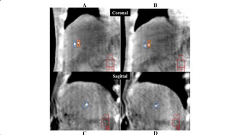 Four Dimensional Cone Beam Computed Tomography 4d Cbct Images Of The