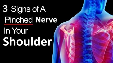 Pinched Nerve In Arm Symptoms