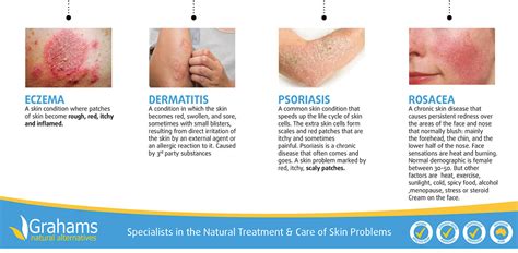Remedies For Skin Conditions Such As Eczema Psoriasis Rosacea