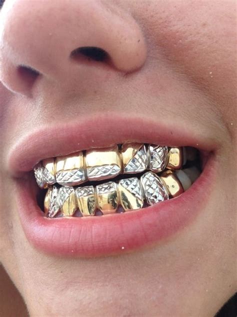 The Classy Issue Grillz Grillz Teeth Gold Grillz
