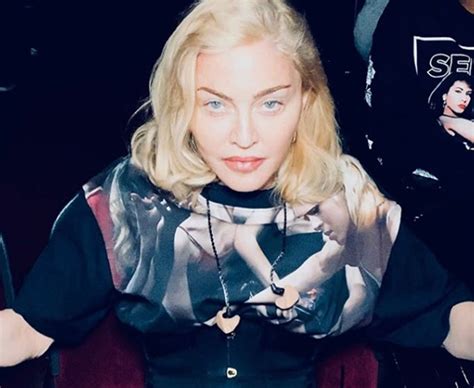 Madonna Está Irreconhecível Por Causa Das Plásticas Flashes Flash