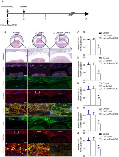 Lncrna Cox2 Inhibits Epidural Fibrogenesis Initiation A Schematic Download Scientific