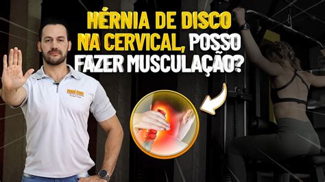 H Rnia De Disco Na Cervical Pode Fazer Muscula O Fisioprev Com Guilherme Stellbrink Youtube