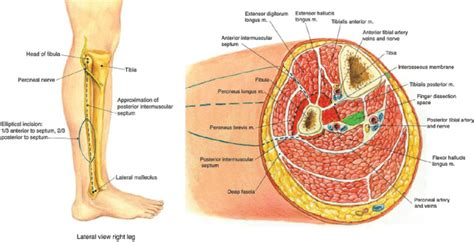 Not very descriptive with anatomy and hard to follow. Topographical anatomy and cross-sectional anatomy of the ...
