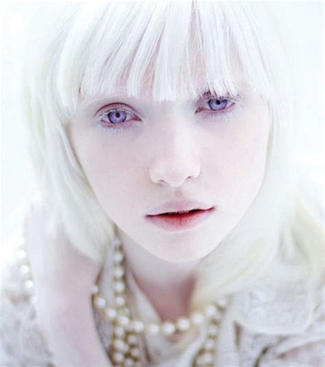 Albinos De Olhos Vermelhos