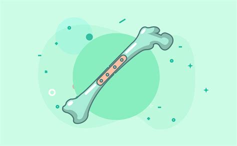 Cannabidiol (cbd) is an oil derived from the cannabis plant. CBD for Osteoporosis: Can Hemp Oil Help Reverse Bone Loss?