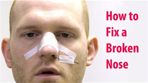 How To Do Broken Nose Makeup Mugeek Vidalondon